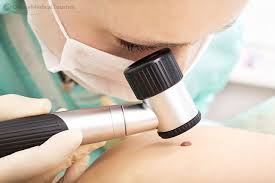 dermatoscopy